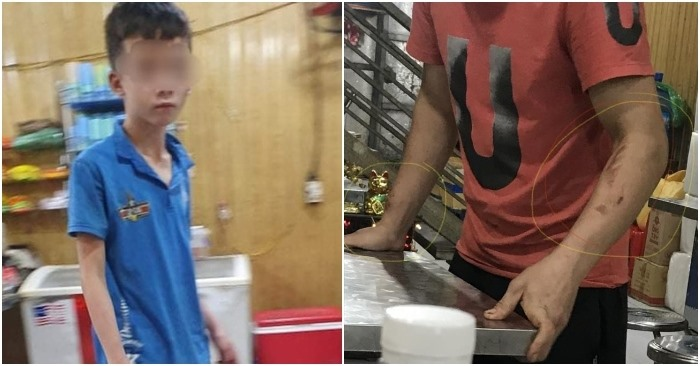 Người cứu cậu bé bị chủ tra tấn kể lại thời khắc nạn nhân đứng co ro cạnh chùa