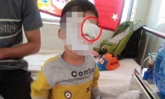 Bé trai bị bạn bắn bút chì trúng mắt: Phòng GD-ĐT sẽ xử lý nghiêm giáo viên