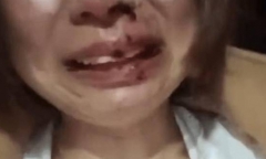 Đăng ảnh ly hôn lên mạng, cô gái bị nhà chồng cũ đánh đập dã man