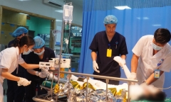 Đi câu cá, thiếu niên 13 tuổi bị điện giật bỏng 90% cơ thể