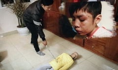 Khởi tố, bắt giam ông bố bạo hành dã man con trai 10 tuổi ở Hà Nội