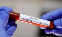Virus corona quá 'xảo quyệt', bệnh nhân xét nghiệm lần thứ 5 mới biết nhiễm bệnh