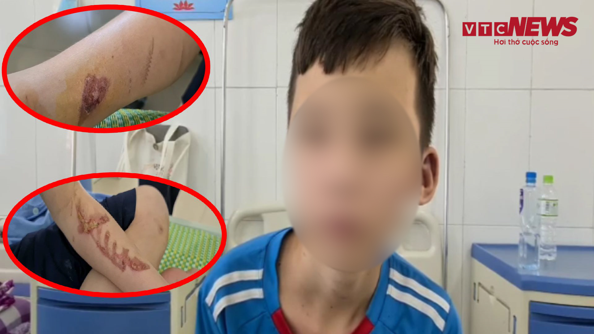 Người cứu cậu bé bị chủ tra tấn kể lại thời khắc nạn nhân đứng co ro cạnh chùa