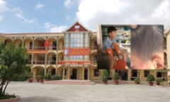 Nam sinh bị ấn đầu vào tường, đập vào giá đỡ bình cứu hỏa: UBND huyện thông tin chính thức