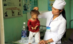 Hội chứng Seckel 'người tí hon': Triệu chứng là gì, phòng bệnh ra sao?