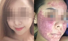 Bị mỹ phẩm phá nát mặt, cô gái phải dừng hôn lễ