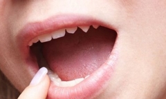 Lè lưỡi soi gương, nhìn màu lưỡi biết ngay bệnh cơ thể