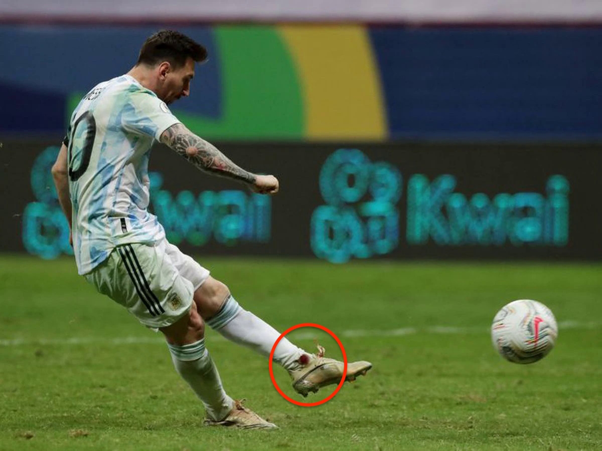Cận cảnh hình xăm gớm ghiếc của Messi