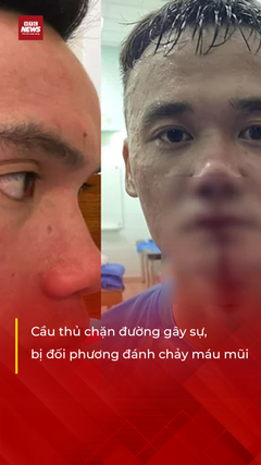 Cầu thủ chặn đường gây sự, bị đối phương đánh chảy máu mũi