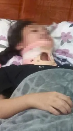 Khởi tố 6 bị can trong vụ nữ sinh ở Thanh Hoá bị đánh gãy đốt sống cổ