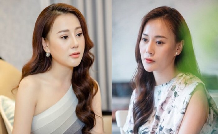 'Quỳnh búp bê': Phẫu thuật thẩm mỹ vì năm lớp 7 đánh nhau, mũi va chạm