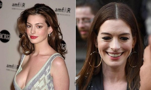 Anne Hathaway - từ công chúa teen đến ngôi sao xuống sắc ở tuổi 37