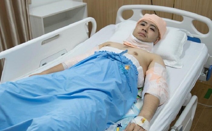Akira Phan phẫu thuật thẩm mỹ sau khi bị chê xuống sắc, phát tướng