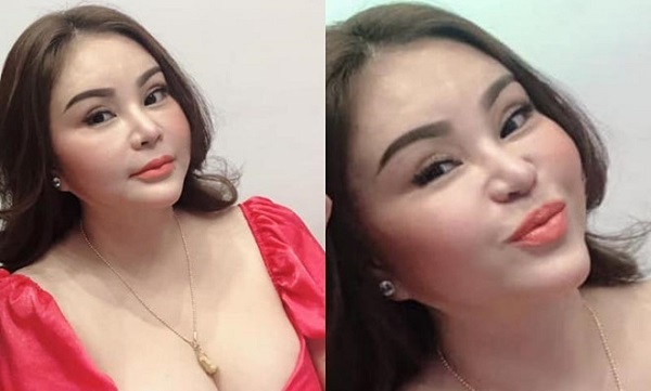 Lê Giang bị nhận xét mặt cứng đờ, sưng phù sau nhiều lần thẩm mỹ