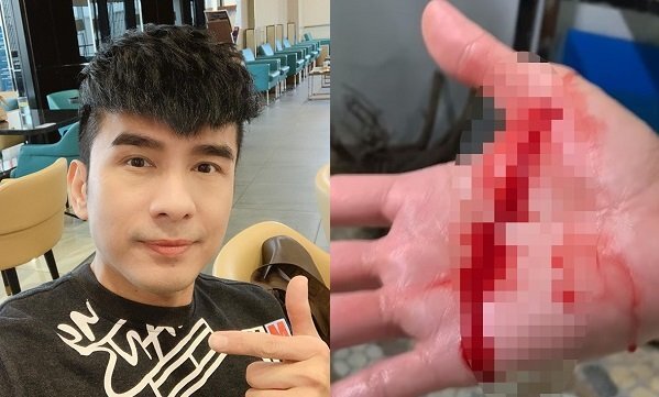 Đan Trường bị cá hổ Piranha cắn chảy máu tay không ngừng