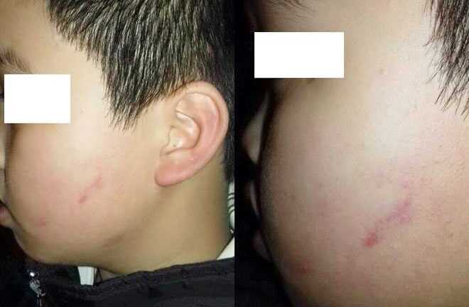 Đình chỉ dạy giáo viên cho 42 học sinh tát vào mặt bé trai