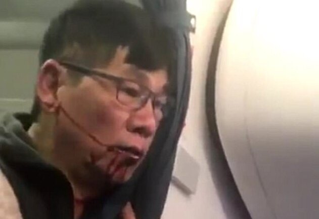 United Airlines bồi thường lớn cho bác sỹ gốc Việt