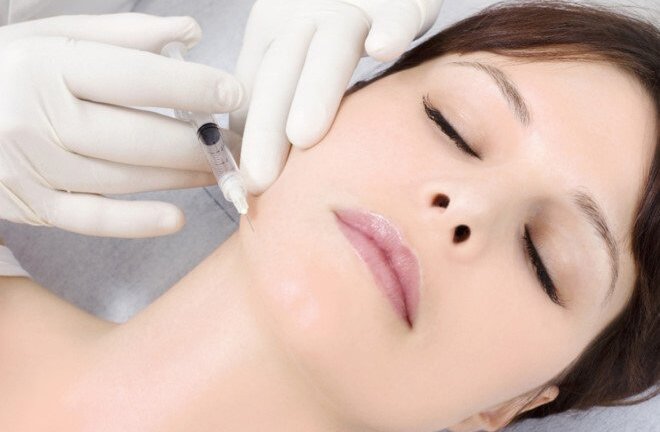 Phẫu thuật căng da mặt và những biến chứng có thể xảy ra