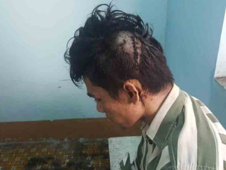 2 thanh niên huyết chiến 'một mất một còn' vì... 300 nghìn đồng giữa phố ở TPHCM