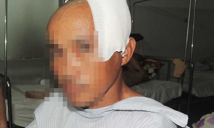 Nhậu say, truy sát, đâm chém dã man gia đình người tình trong đêm