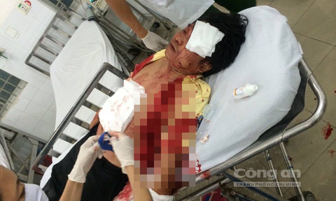 Côn đồ hung hãn trút ‘mưa dao’ lên tài xế taxi cướp tài sản