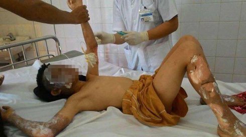 Rò khí gas gây nổ lớn ở Lào Cai, 10 người bị thương