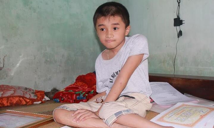 Cậu bé xương thủy tinh đến trường trên lưng mẹ vừa giật giải quốc gia học sinh giỏi tiếng Anh trên Internet