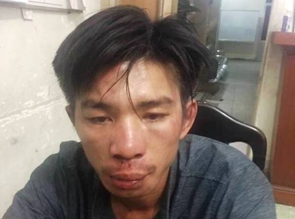 'Yêu râu xanh' dùng 'chiêu' giả đại gia thuê người yêu, hại đời bé gái 15 tuổi