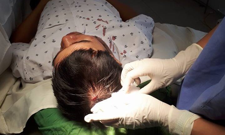 Bác sĩ bị tấn công bằng máy đo huyết áp