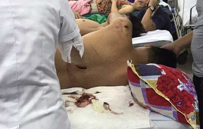Thanh niên bị côn đồ mang dao kiếm bịt mặt truy sát chém kinh hoàng: Bắt 6 nghi can