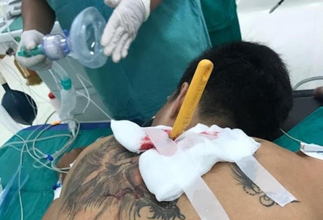 Thanh niên xăm trổ bị bạn gái vung dao đâm lút cán từ phía sau