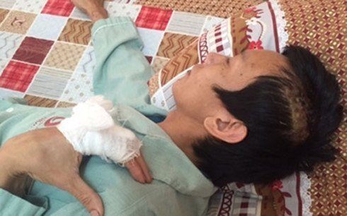 Đi ăn đêm ở Bãi Cháy, người đàn ông bị côn đồ chém xối xả