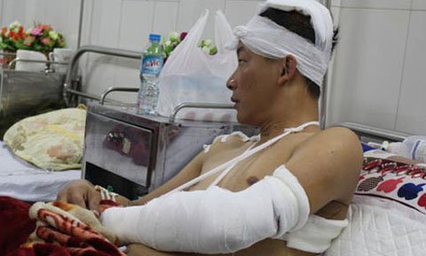 Nam thanh niên bị 3 côn đồ chém trên phố Nghệ An