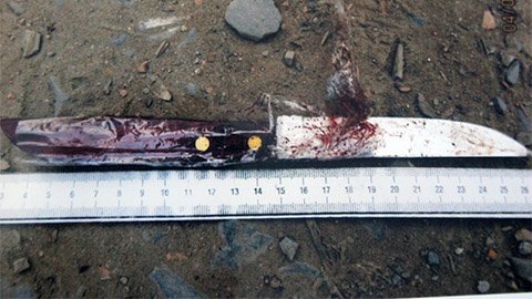 Đang chở hai con nhỏ, cha bị côn đồ truy sát, chém đứt gân tay