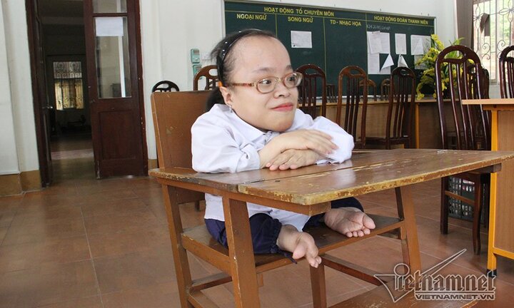 Cô bé nhiễm chất độc da cam từ chối đặc cách, quyết 'vượt vũ môn'