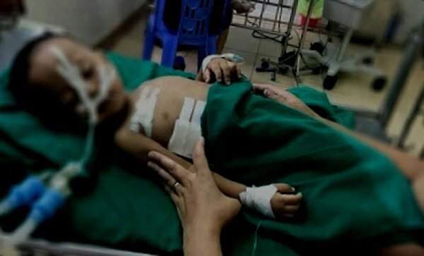 Nghịch súng nhà hàng xóm, bé trai bị đạn găm trúng ngực