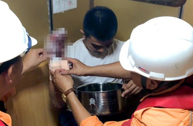 Cứu thuyền viên Philippines bị dập nát tay phải