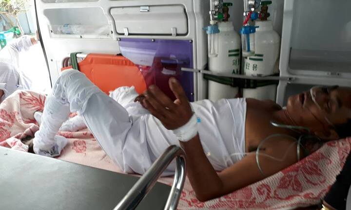 Nổ thùng phuy chứa 200 lít dầu, 3 người bị bỏng nặng