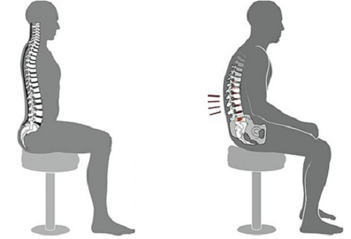 Thói quen dễ gây bệnh xương khớp ai cũng mắc phải