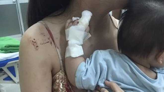 Điếng người thấy con bị chuột cắn nát tay, máu thấm đẫm ga giường