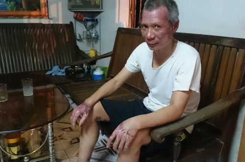 Người đàn ông ôm 'bom gas' cứu vợ và hàng chục học sinh: Phát hiện tình tiết bất ngờ