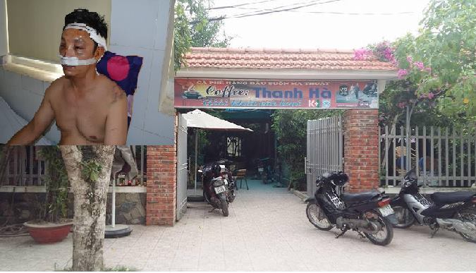 Đang ngồi chơi, bị nhóm côn đồ nổ súng vào đầu