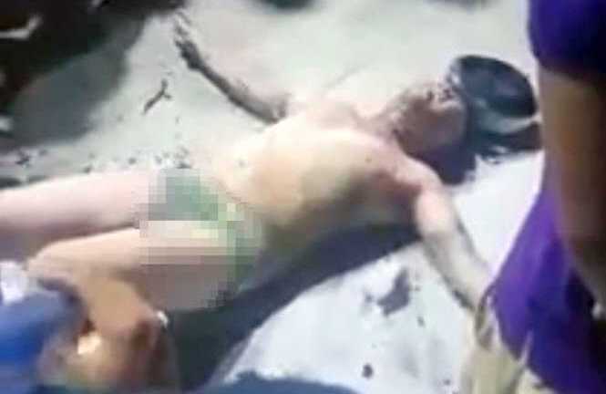 Hút thuốc ở cây xăng, nam thanh niên bốc cháy như ngọn đuốc