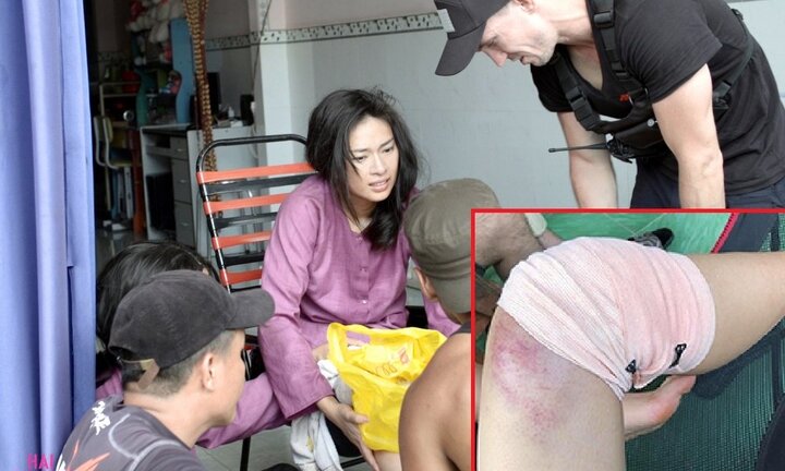 Sao Việt tai nạn nghề nghiệp: Ngô Thanh Vân nứt xương nghiêm trọng, Lý Hải rạn xương sườn