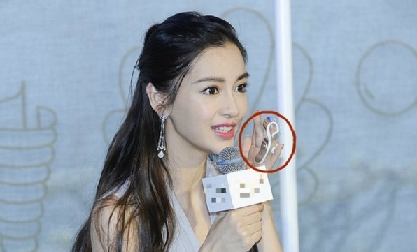 Angela Baby phải đeo nẹp ngón tay sau tai nạn quay show