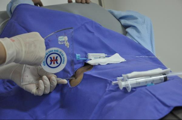 Ứng dụng, cải tiến kỹ thuật sinh thiết phổi cắt xuyên thành ngực