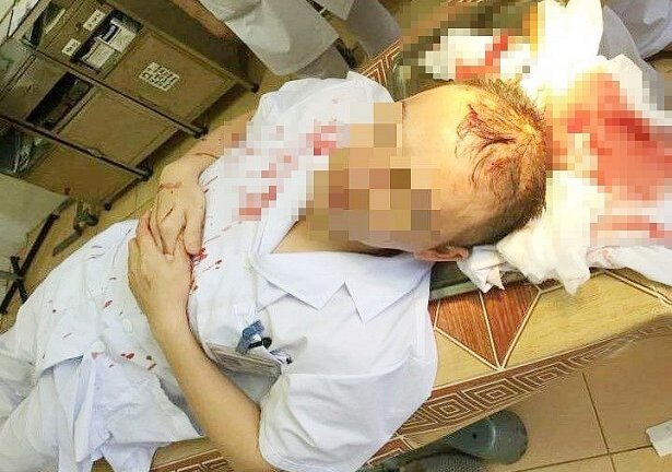 Hành hung, đánh trọng thương bác sĩ: Côn đồ hoành hành bất chấp đạo lý, nhân tính con người
