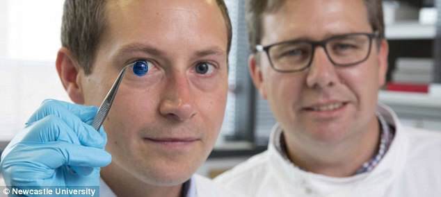 Ngỡ ngàng tạo hình giác mạc nhân tạo bằng kỹ thuật in 3D