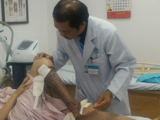 Cứu bàn chân bị hoại tử cho nữ sinh bị xe tải tông