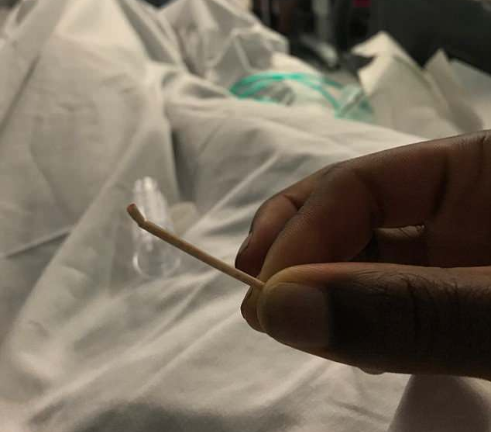 Người phụ nữ vật lộn khi que tránh thai ‘đi lạc’ tới tim, tắc động mạch phổi